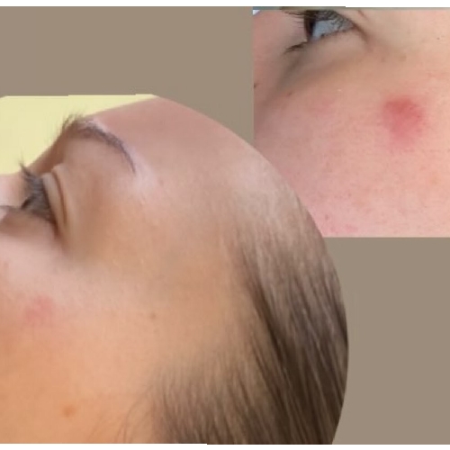 C SERUM